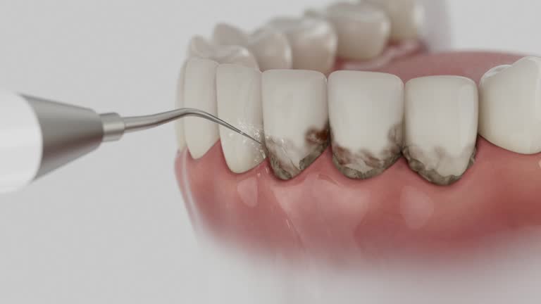 Reliable Dental contractor in Jacksonville, IL by Dentist Open Now
